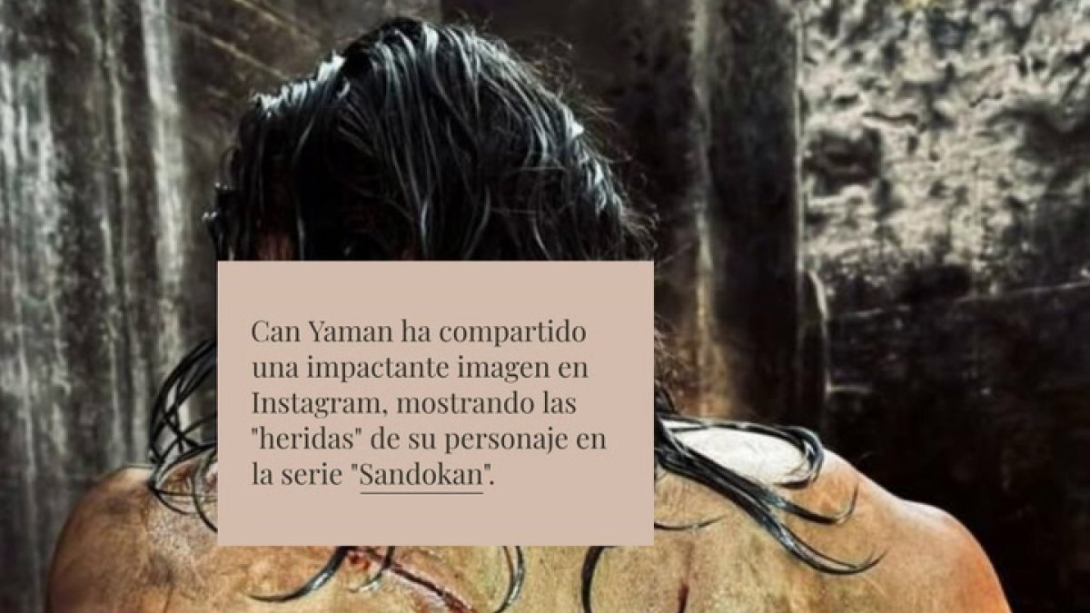 Can Yaman muestra sus sangrientas 'heridas' durante el rodaje de 'Sandokan', su nueva serie